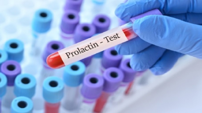 prolactin